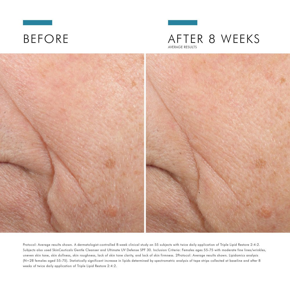SkinCeuticals Triple Lipid Restore 2:4:2 Anti-Aging Moisturizing Cream 48ml - Image 8