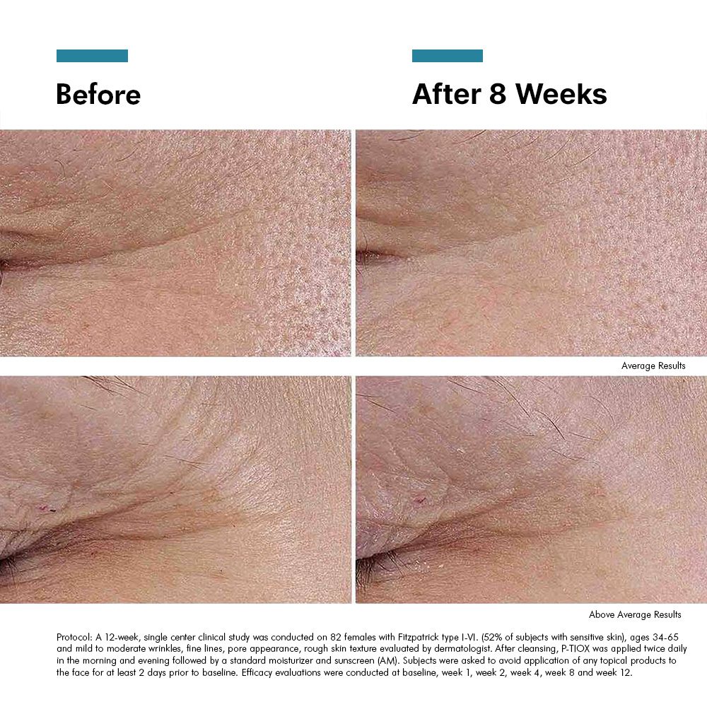 SkinCeuticals P-TIOX Anti-Wrinkle Peptide Serum 30ml - Image 9