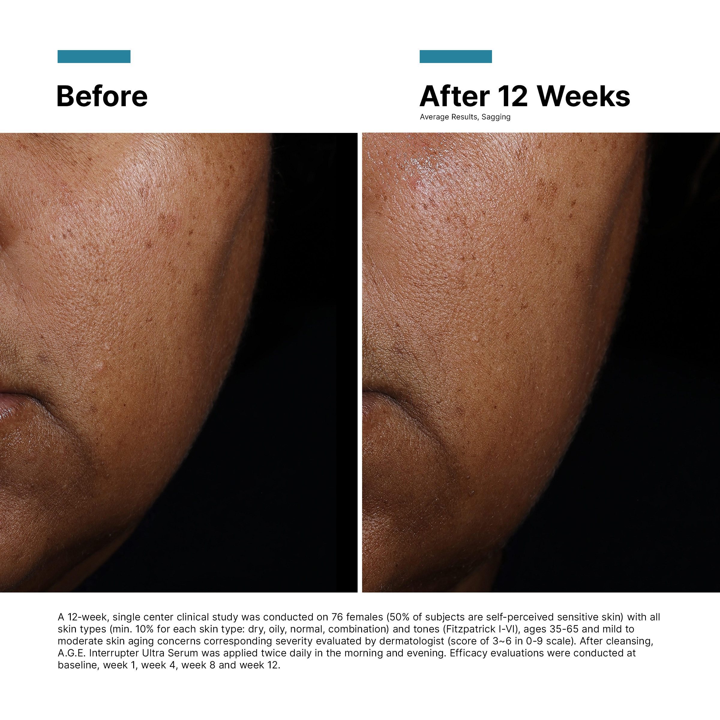 SkinCeuticals A.G.E Interrupter Ultra Skin Lifting & Tightening Serum 30ml - Image 10