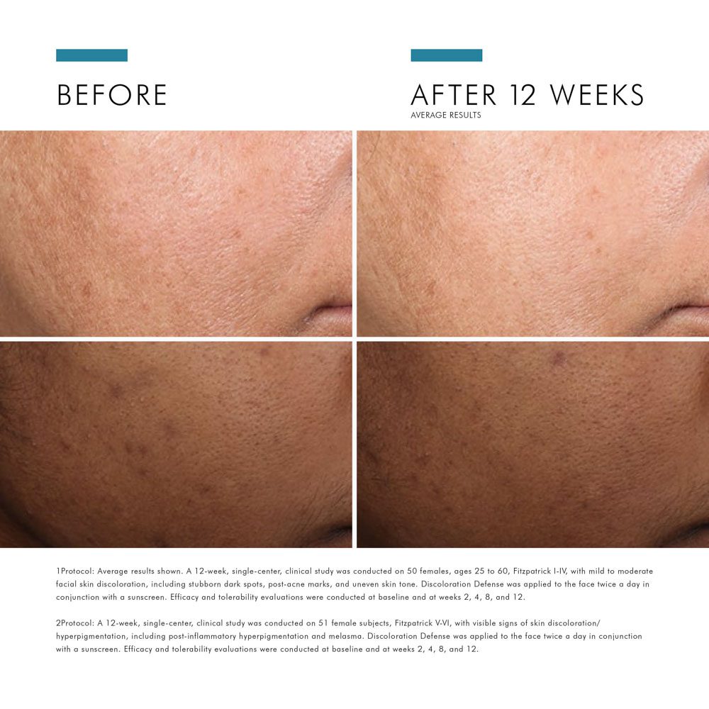 SkinCeuticals Discoloration Defense 5% Niancinamide Serum 30ml - Image 8
