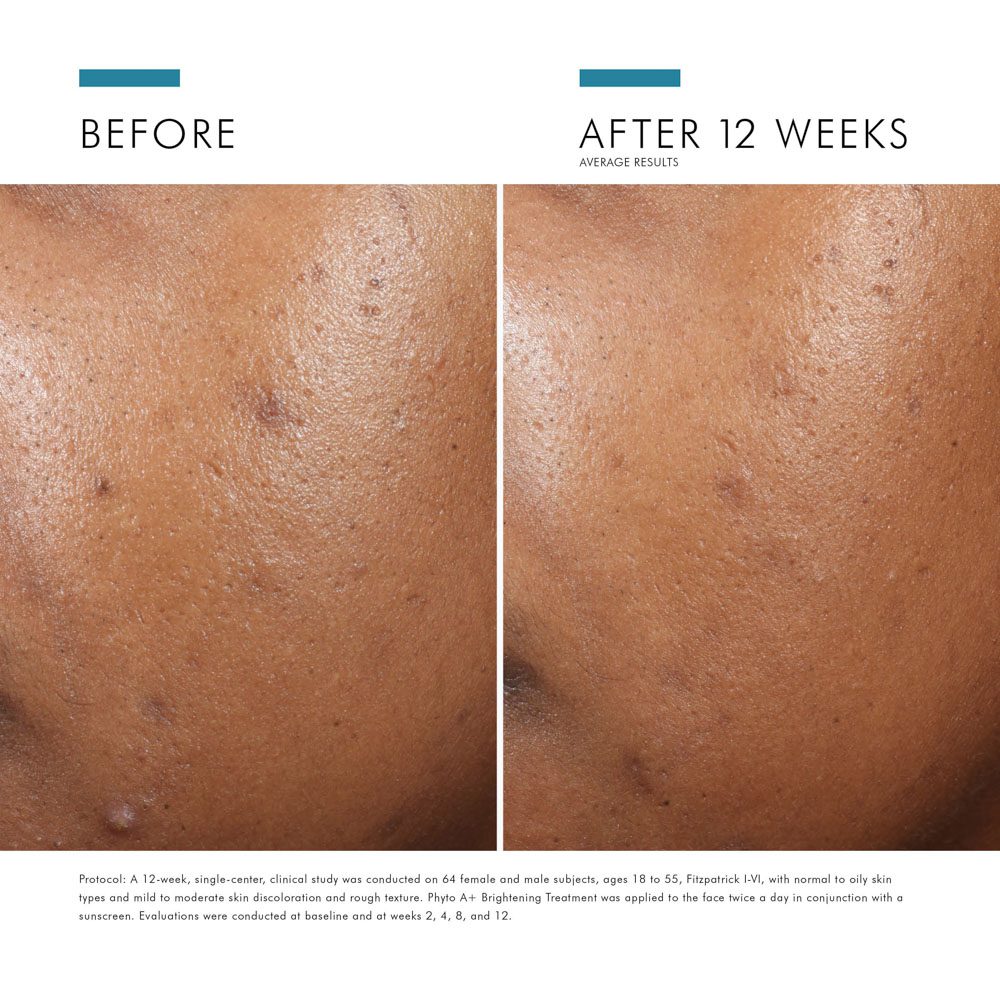 SkinCeuticals Phyto A+ Brightening Treatment Daily Corrective Moisturiser 30ml - Image 13